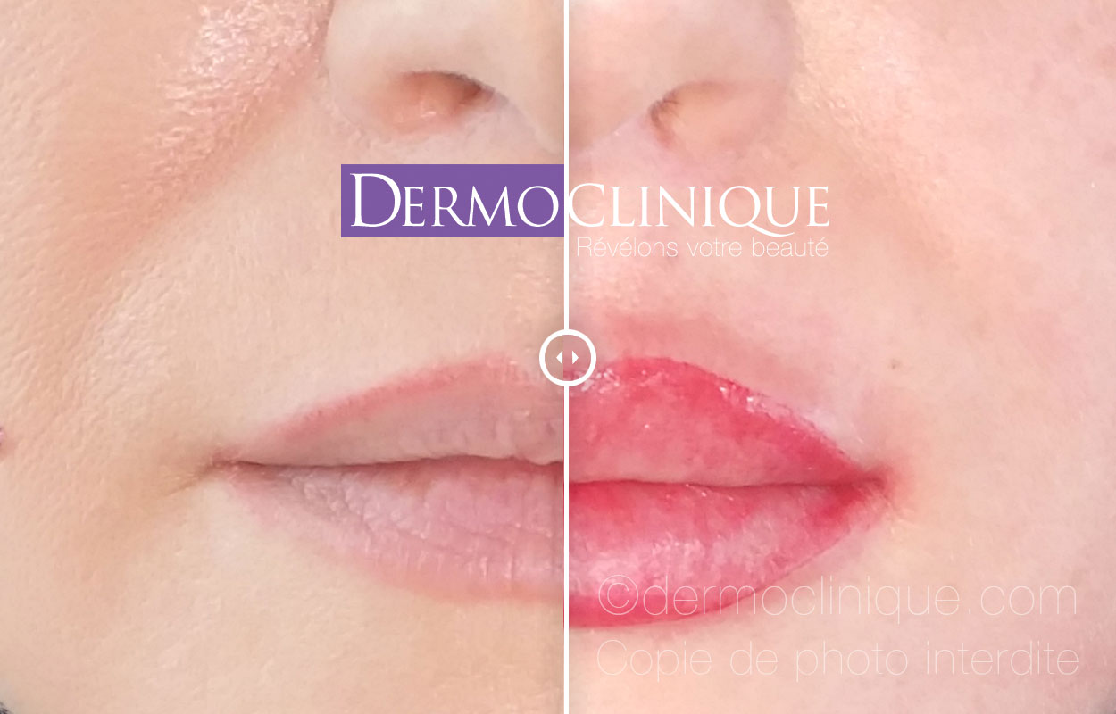 maquillage permanent levres